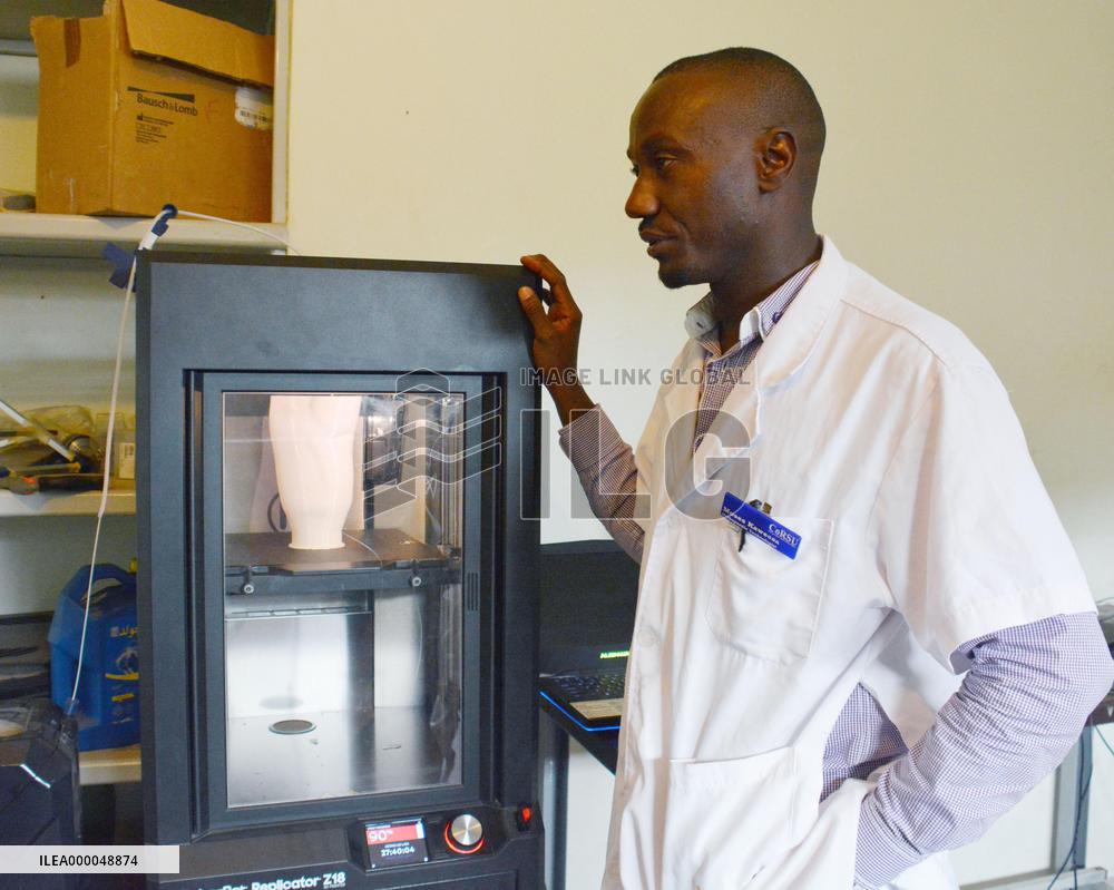 Prosthetic production with 3D printer underway at Uganda hospital
