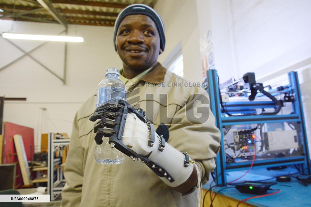S. African man gets artificial hand made by 3D printer