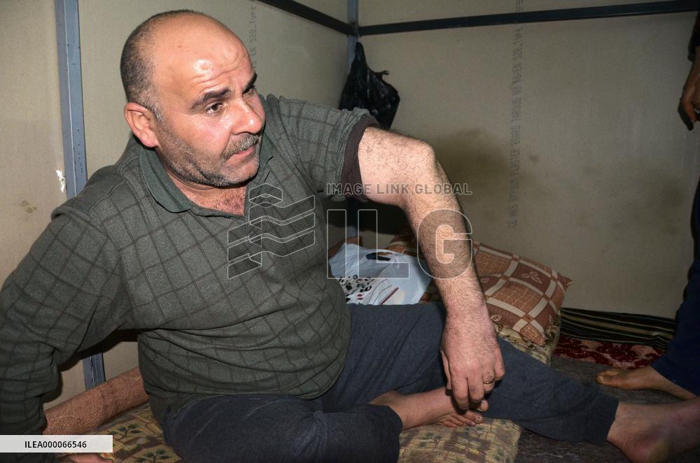 Iraqi refugee shows arm broken by Islamic State militants