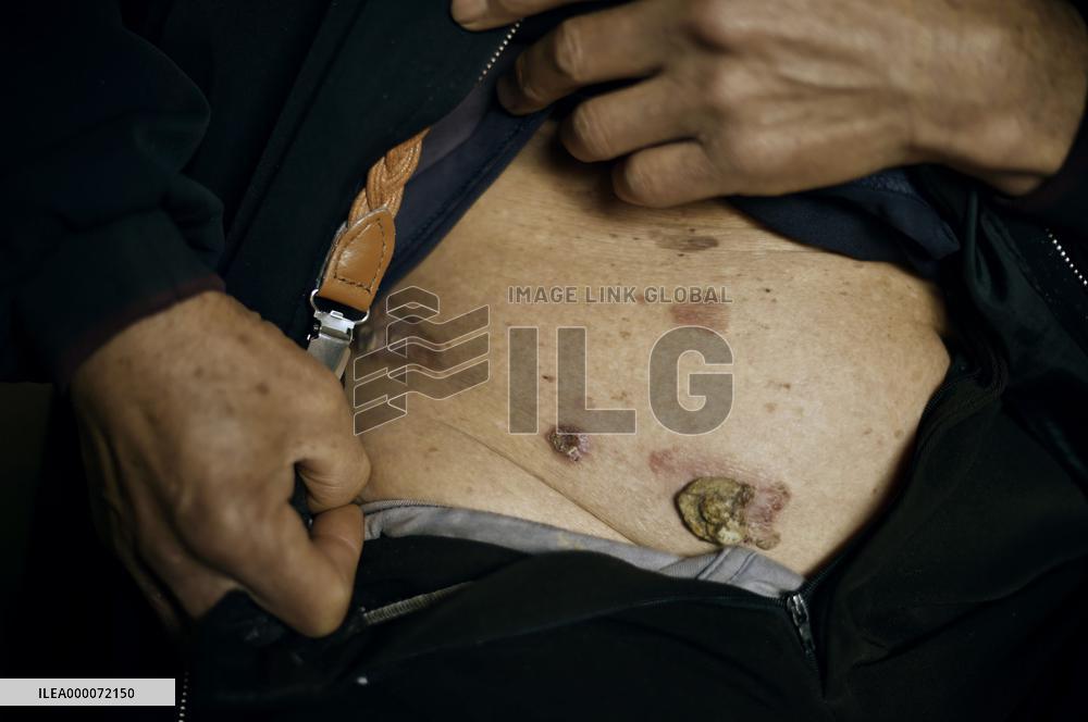 Chinese village plagued by arsenic poisoning for over 6 decades