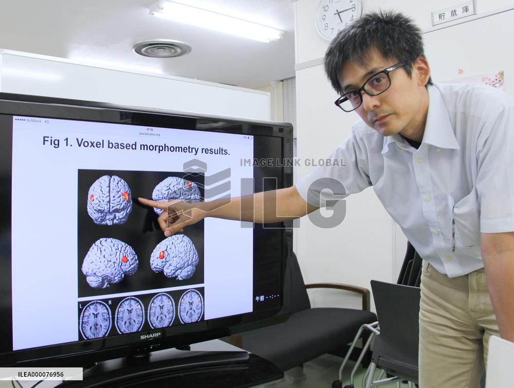 Adolescence anorexia linked to decreased brain volume: Japan researchers