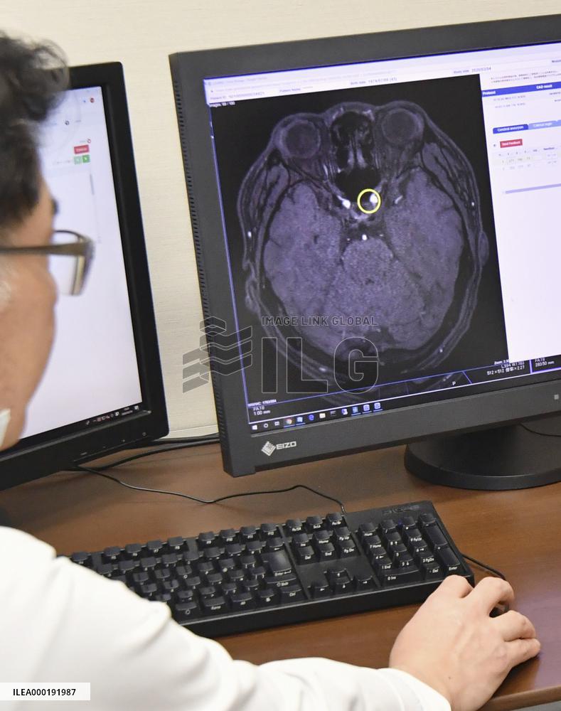 AI in radiology