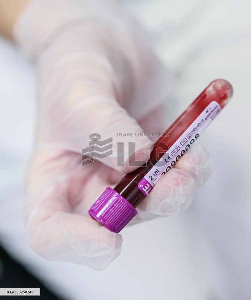 blood donor, sample, Hospital of St. Anna in Brno