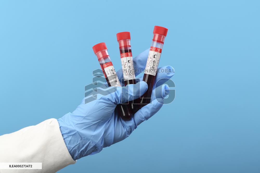 Test, testing, covid-19, coronavirus, vaccine, protective clothing, gloves, blood, laboratory flash, antibodies, research, glass tube, tubes