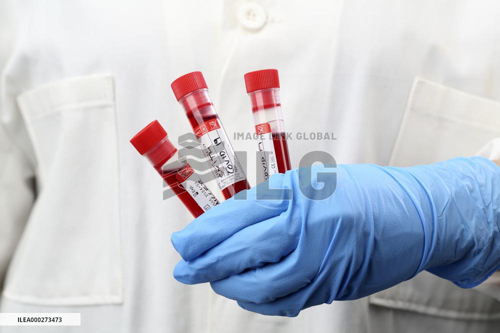 Test, testing, covid-19, coronavirus, vaccine, protective clothing, gloves, blood, laboratory flash, antibodies, research, glass tube, tubes