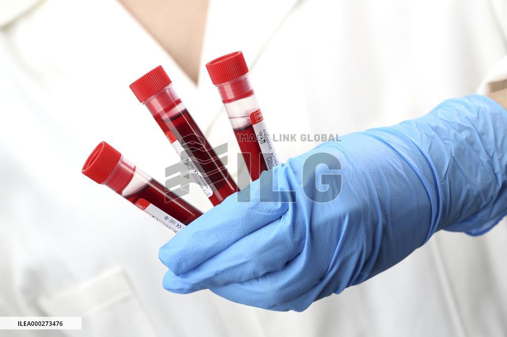 Test, testing, covid-19, coronavirus, vaccine, protective clothing, gloves, blood, laboratory flash, antibodies, research, glass tube, tubes