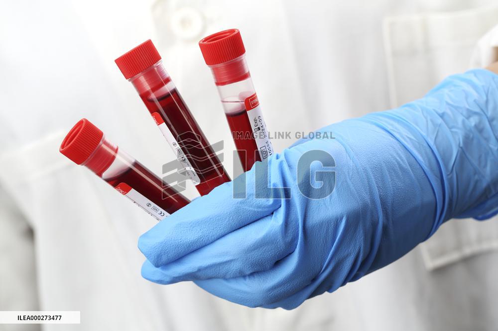 Test, testing, covid-19, coronavirus, vaccine, protective clothing, gloves, blood, laboratory flash, antibodies, research, glass tube, tubes