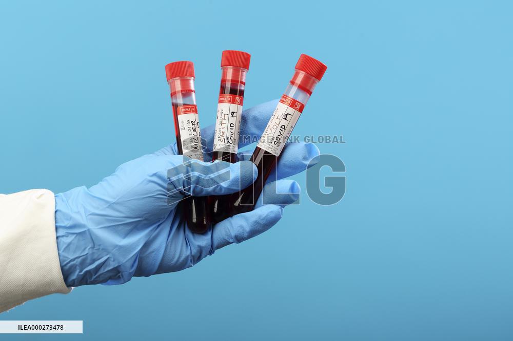 Test, testing, covid-19, coronavirus, vaccine, protective clothing, gloves, blood, laboratory flash, antibodies, research, glass tube, tubes