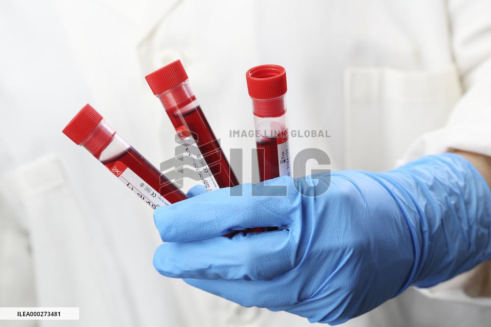 Test, testing, covid-19, coronavirus, vaccine, protective clothing, gloves, blood, laboratory flash, antibodies, research, glass tube, tubes