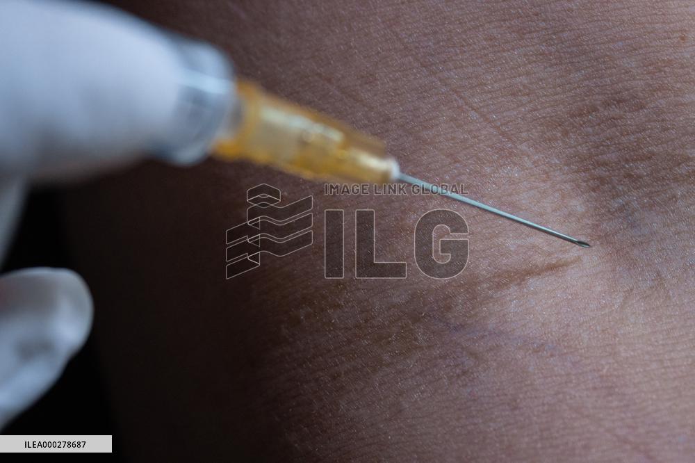 Injection, vains, syringe.