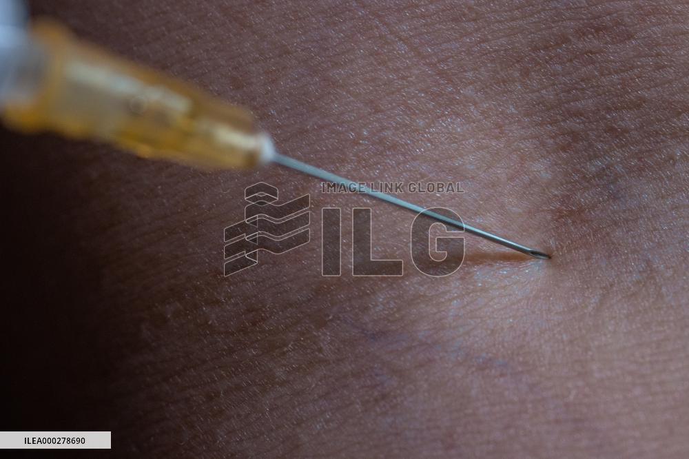 Injection, vains, syringe.