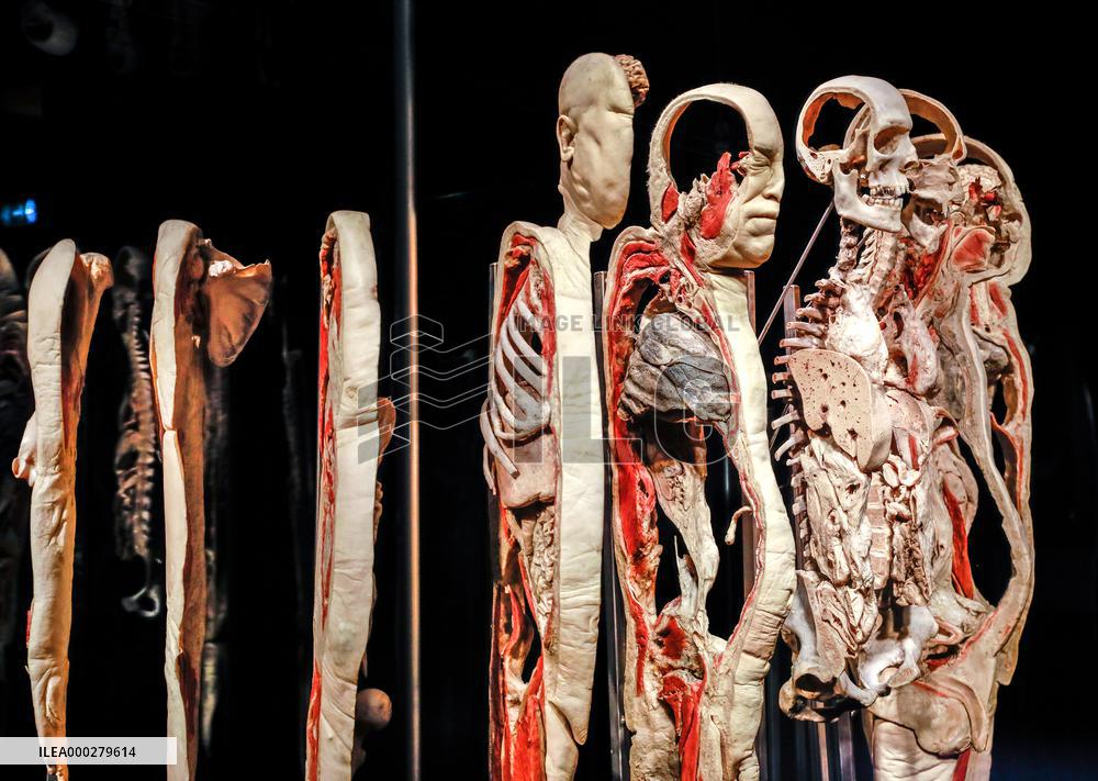 THE HUMAN BODY EXHIBITION, Body Worlds