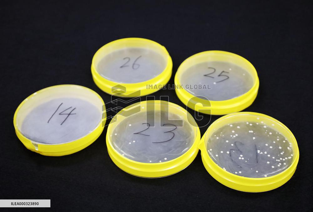Well-travelled yeast