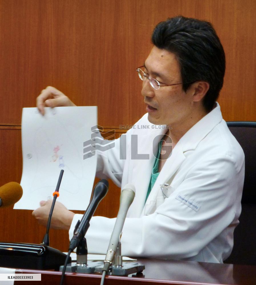 Transplant of donor's left lung to man's right lung