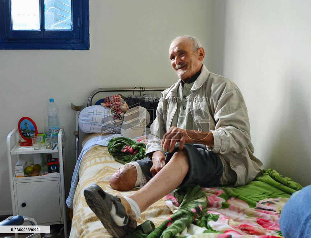 Leprosy patient shows amputated leg in Morocco