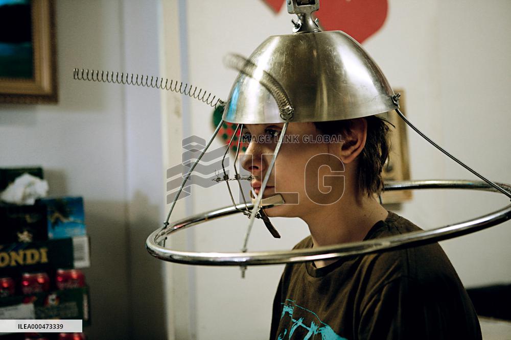 Max Pinlig; Max Embarrassing (2008)