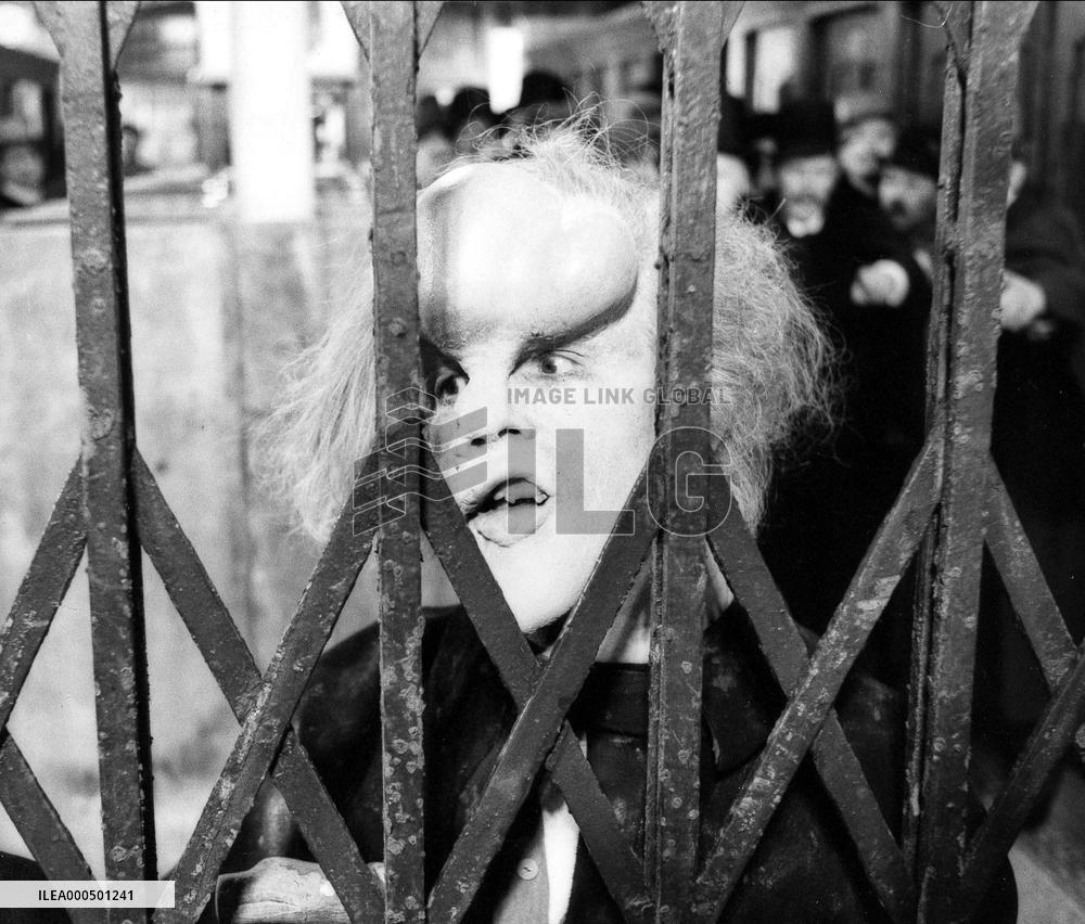THE ELEPHANT MAN