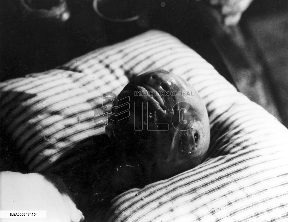 ERASERHEAD