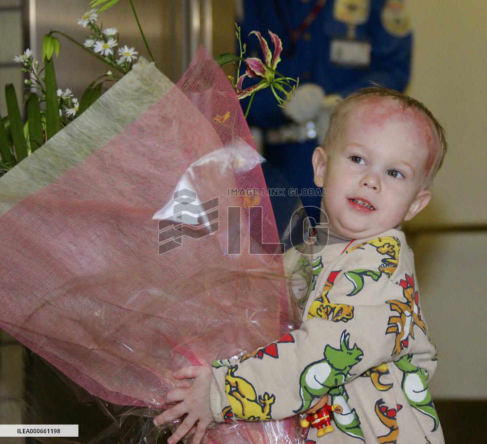 Russian boy leaves hospital after treatment for serious burns