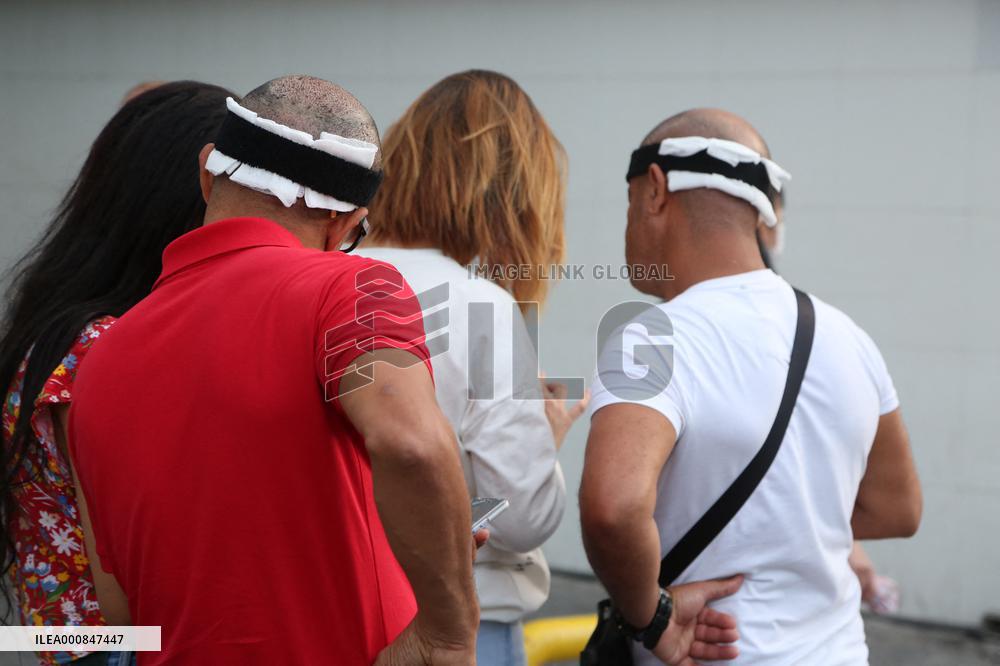 Hair Implants - Turkey