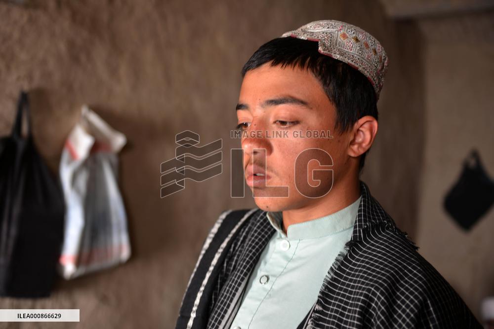 AFGHANISTAN-KANDAHAR-VICTIMS