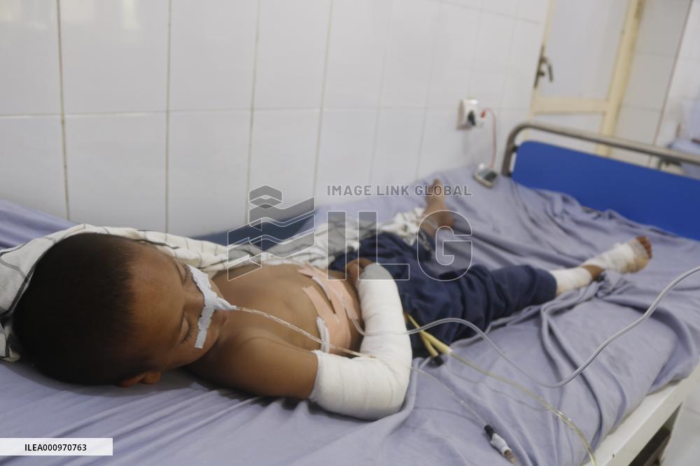 AFGHANISTAN-KUNDUZ-BLAST