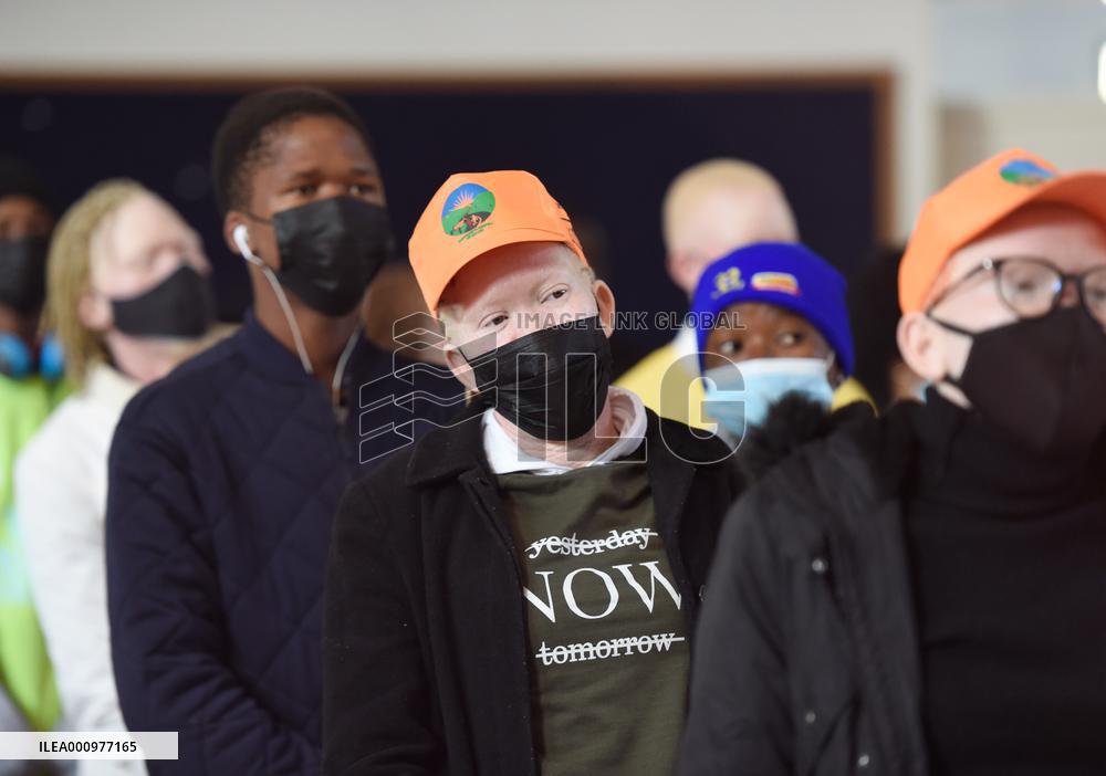 BOTSWANA-GABORONE-INTERNATIONAL ALBINISM AWARENESS DAY