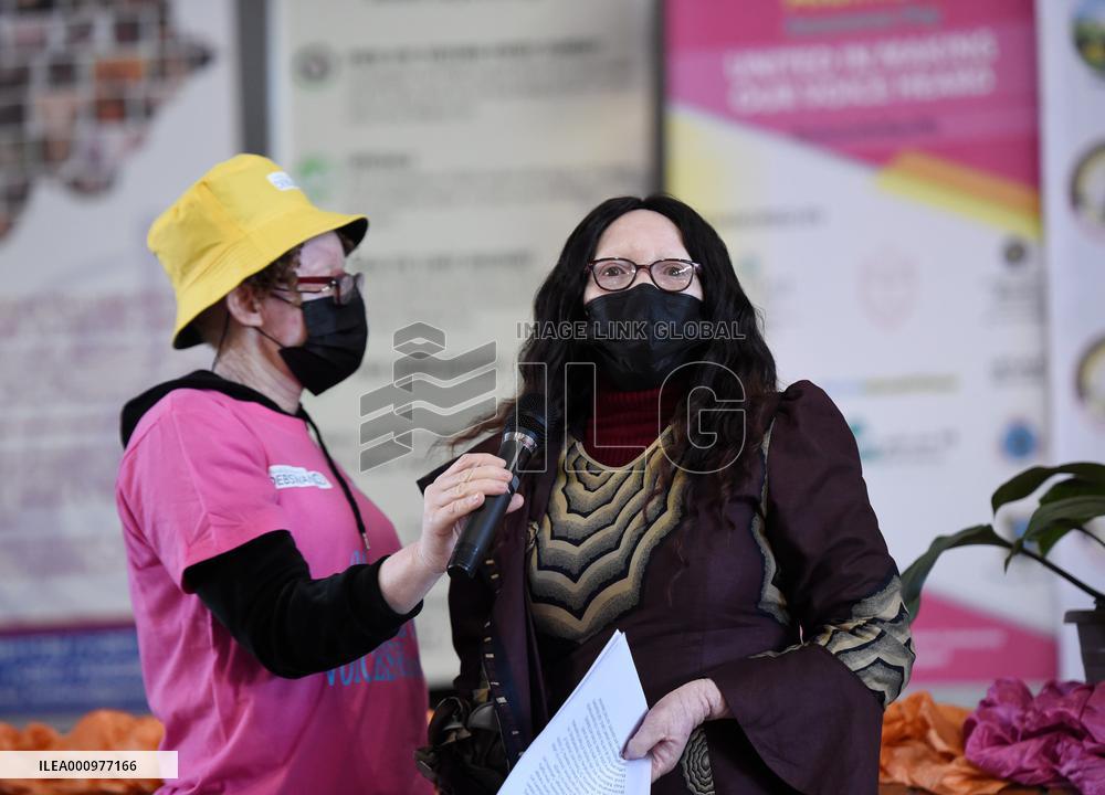 BOTSWANA-GABORONE-INTERNATIONAL ALBINISM AWARENESS DAY