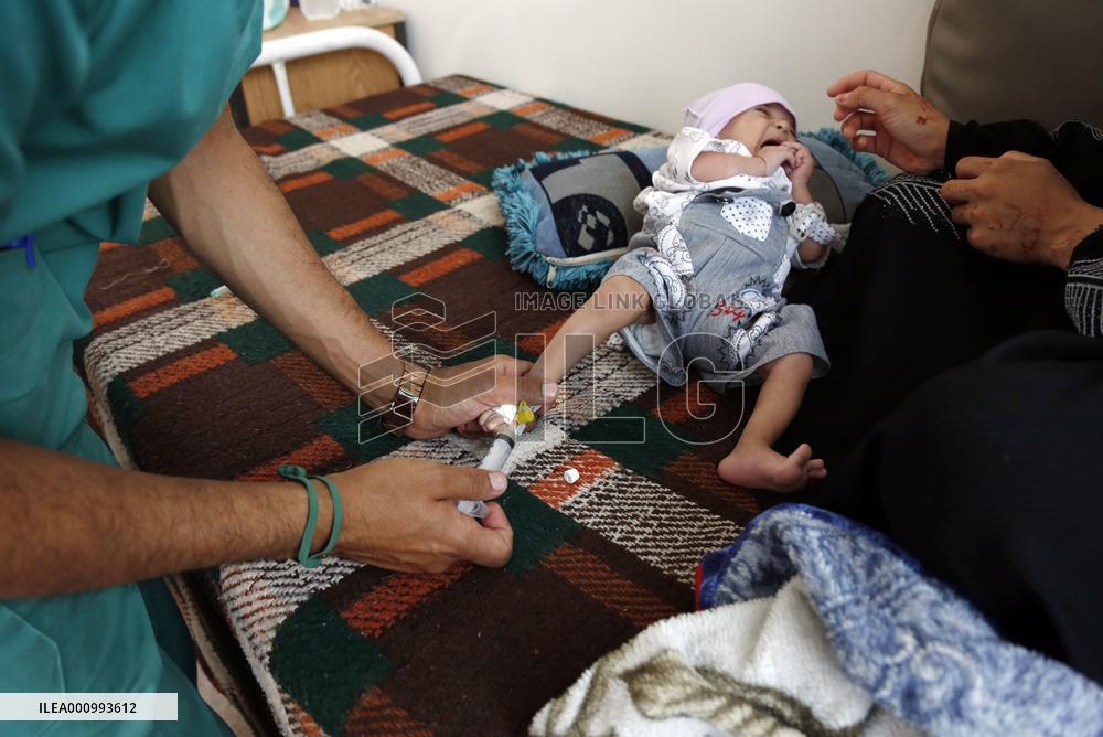 YEMEN-SANAA-CHILDREN-MALNUTRITION