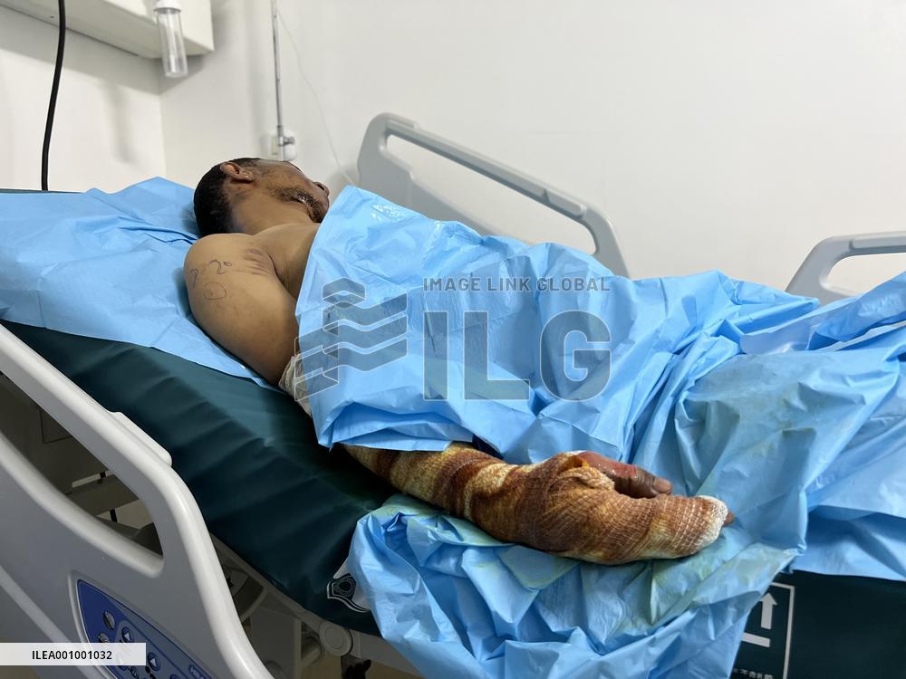 LIBYA-TRIPOLI-FUEL TRUCK EXPLOSION-WOUNDED