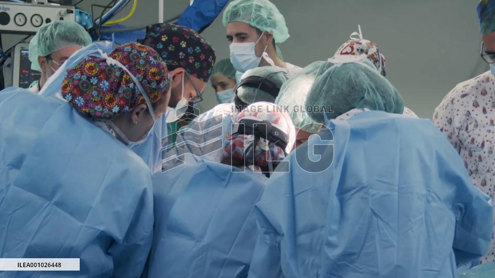 13-month-old baby in Madrid gets intestine transplant in pioneering operation