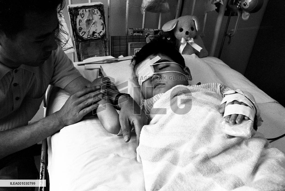 Death of a Second-Generation Atomic Bomb Victim