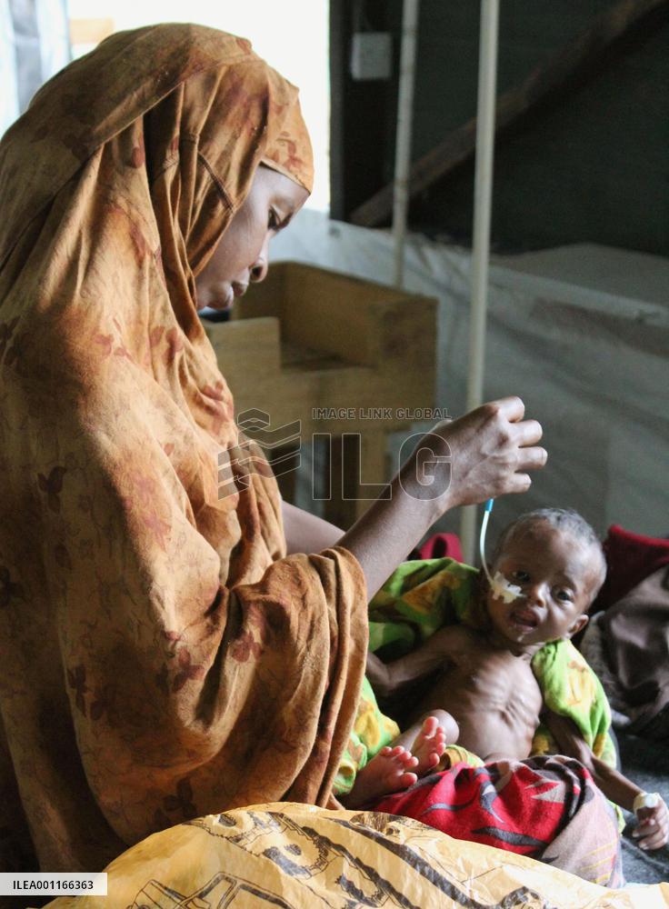 Malnourished child at refugee camp in Kenya