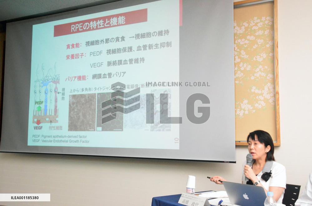 World's 1st iPS clinical research to begin