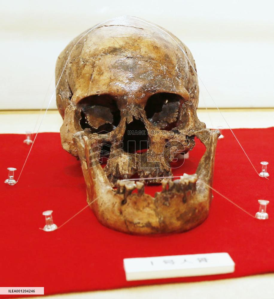 Jomon period woman's skull at Toyama museum