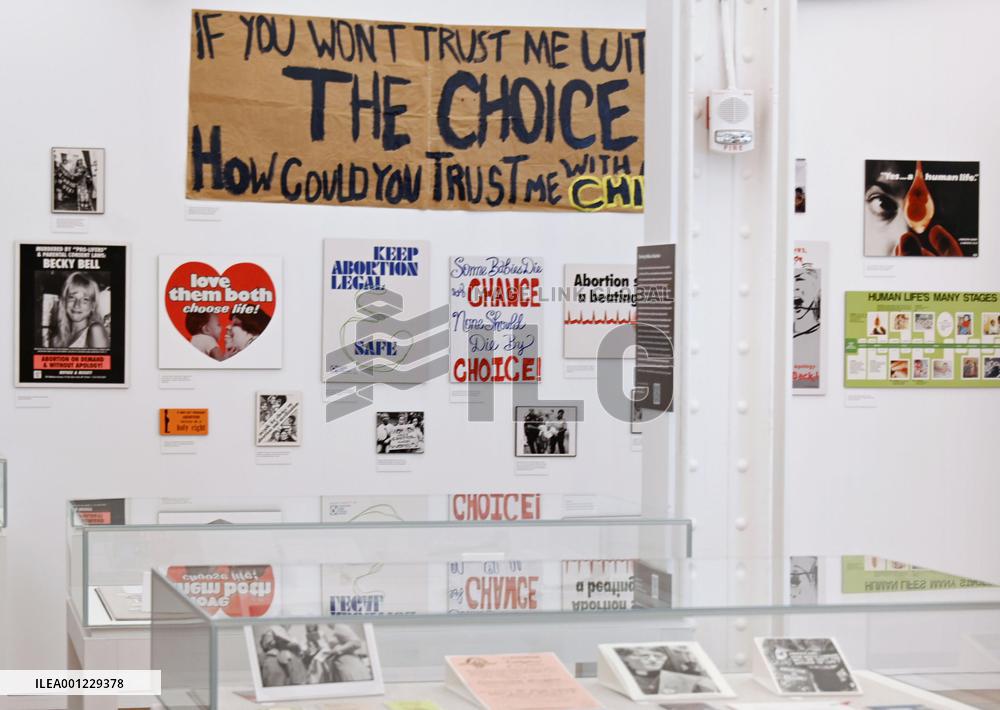 Exhibit on history of abortion in U.S.