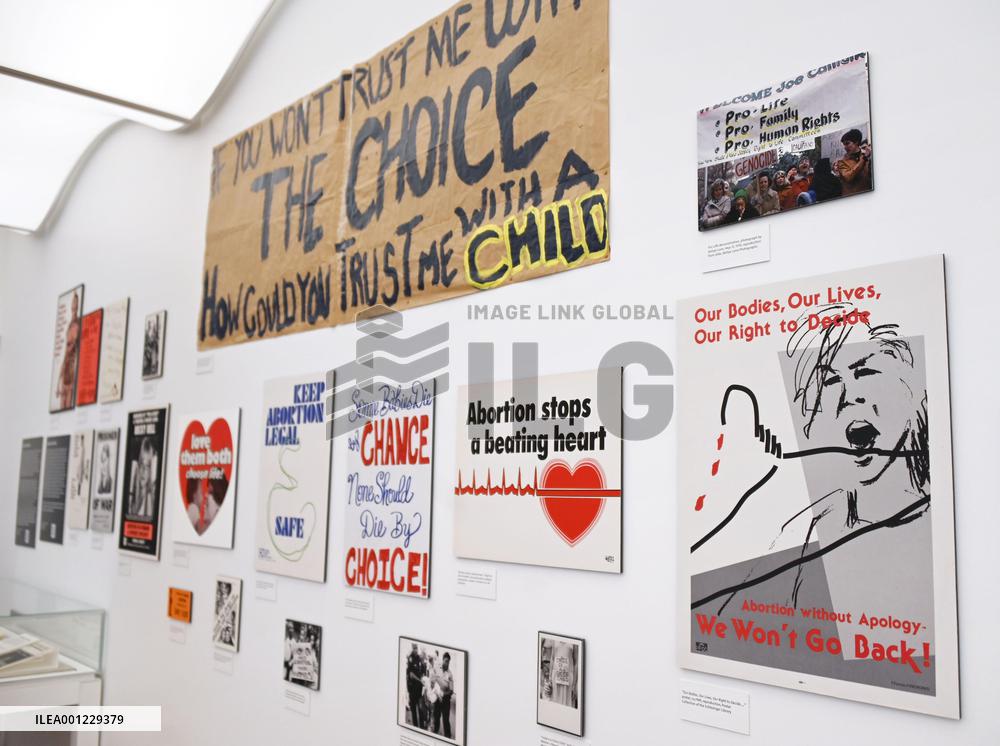 Exhibit on history of abortion in U.S.