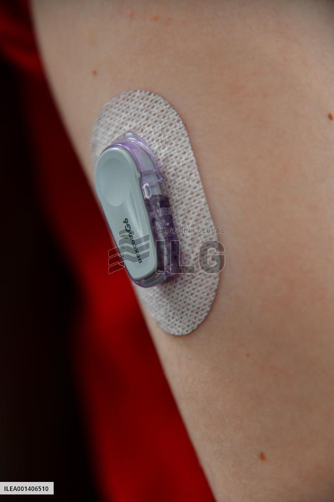 Illustration Monitoring And Treatment Of Type 1 Diabetes