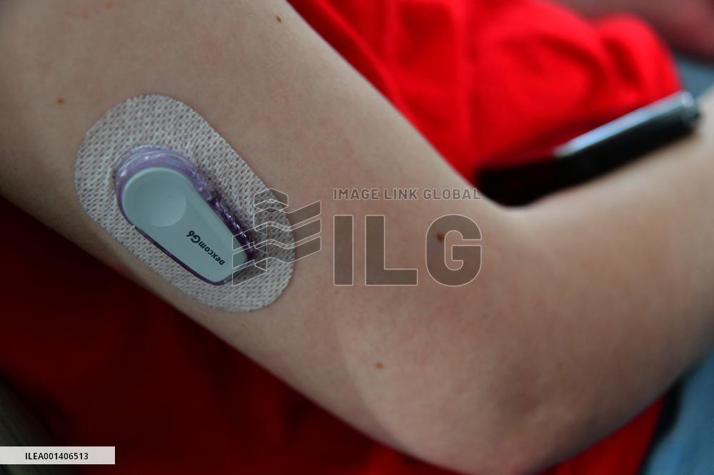 Illustration Monitoring And Treatment Of Type 1 Diabetes