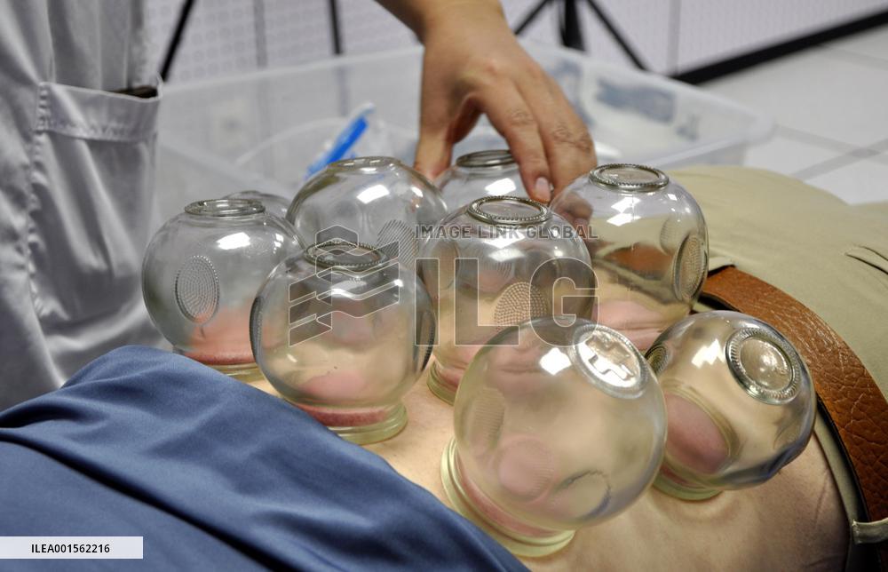 TCM Popular In China