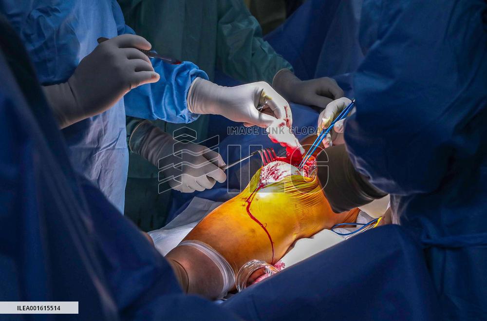 Knee joint replacement surgery in Kyiv