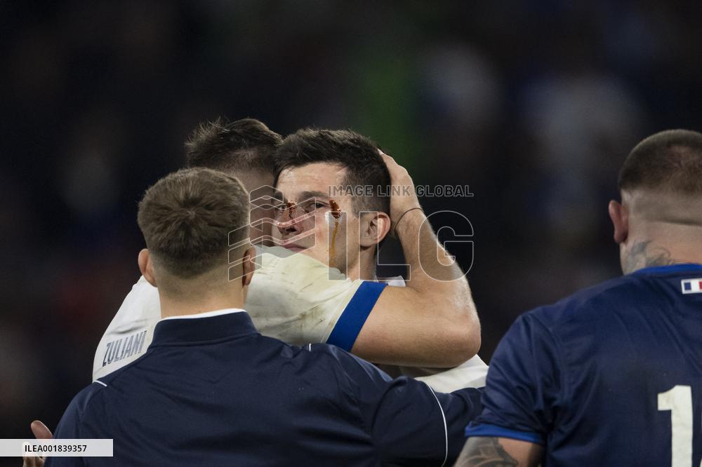 RWC - France v Italy