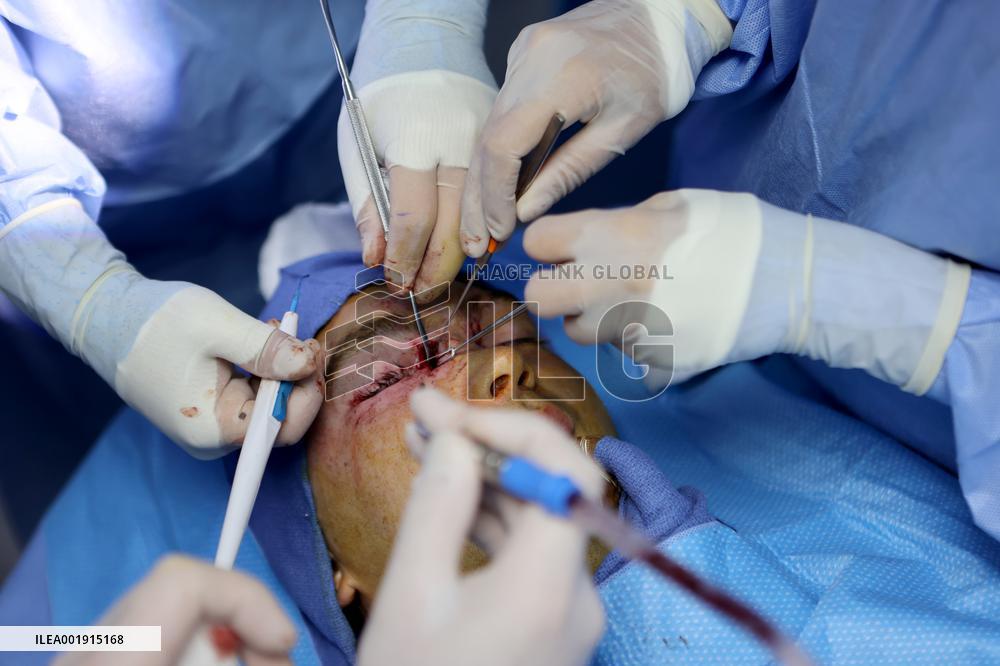 Maxillofacial surgeries for Ukrainian military in Ivano-Frankivsk