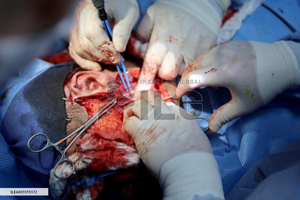 Maxillofacial surgeries for Ukrainian military in Ivano-Frankivsk