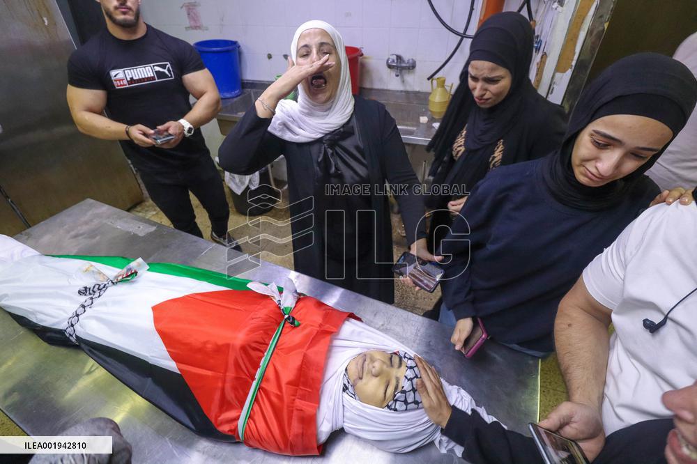 A Child Dies From His Wounds - Nablus