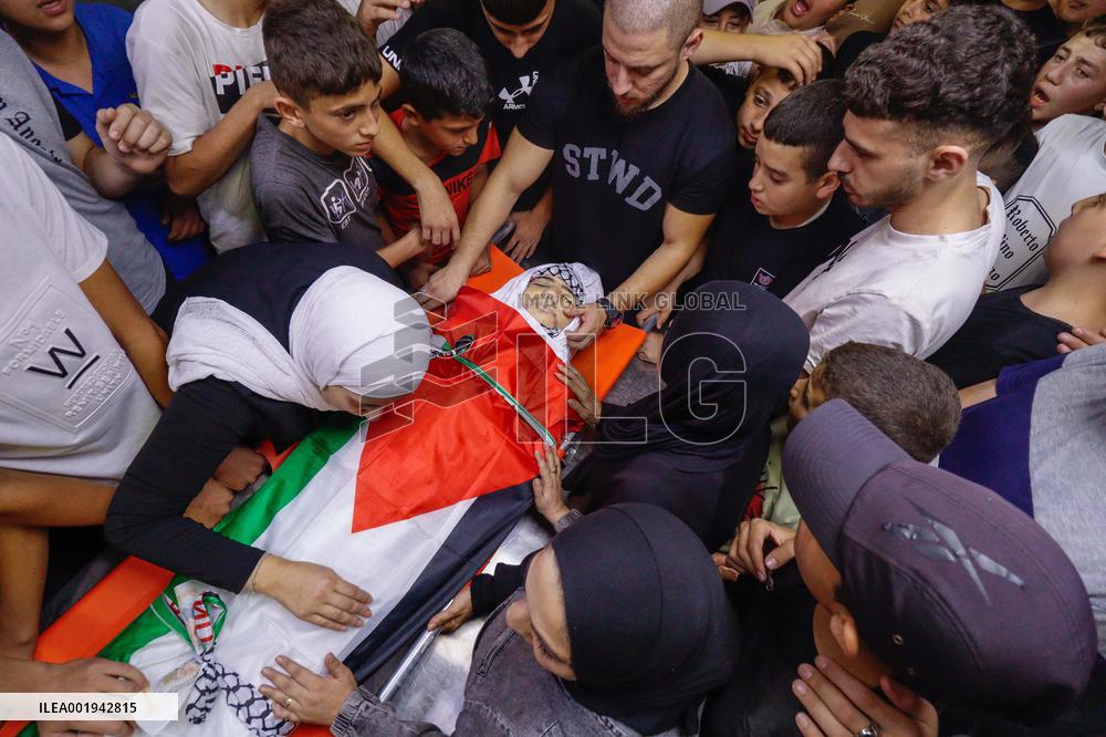 A Child Dies From His Wounds - Nablus