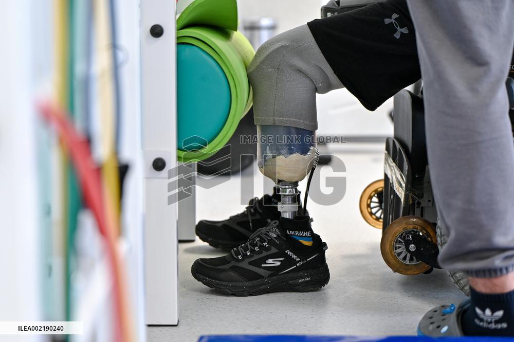 Ukrainian defender with arms and legs amputated in Russian captivity undergoes prosthetics in Lviv