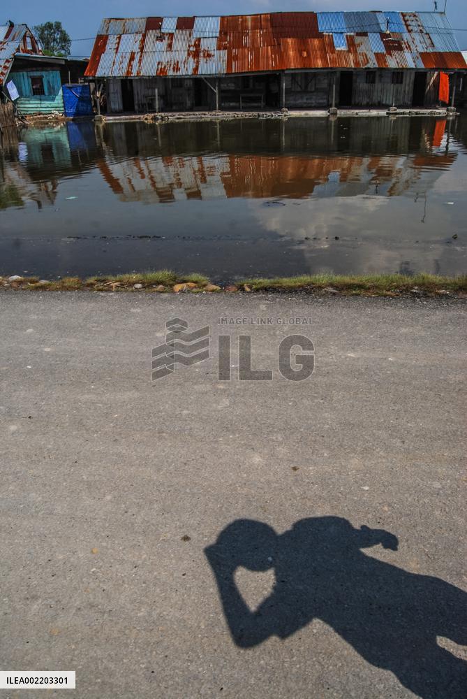 The Burden Of Leprosy In Indonesia