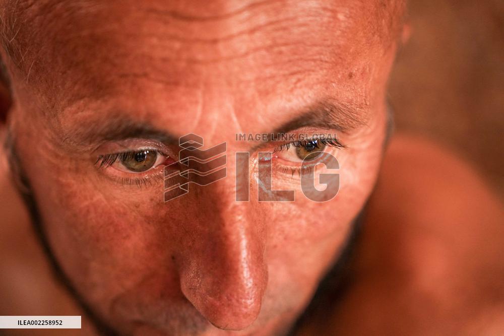 Drug Addicts Find Shelter At Hospital - Kabul