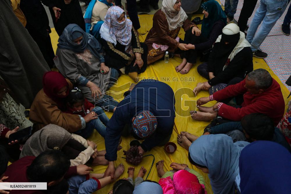 Leech Therapy Treatments - India